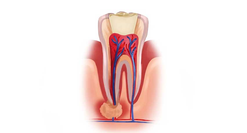 tooth stracture