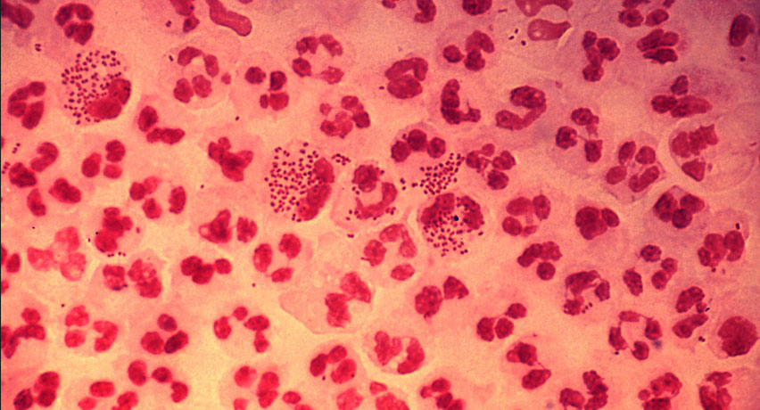 নেইসেসরিয়া গণোরিয়া (Neisseria gonorrhoeae)