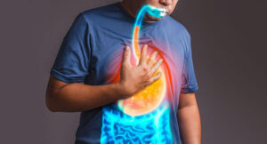 অ্যাসিড রিফ্লাক্স কি? অ্যাসিড রিফ্লাক্সের কারণে মুখে দুর্গন্ধের সৃষ্টি ও তার থেকে মুক্তির উপায়