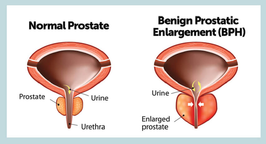 prostate gland